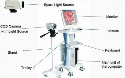 Video Colposcope — view 2