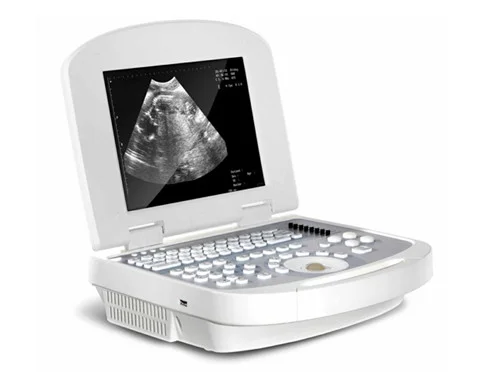 Laptop Ultrasound Scanner