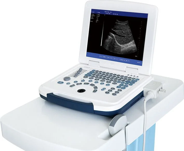 Full Digital Laptop Ultrasound Scanner