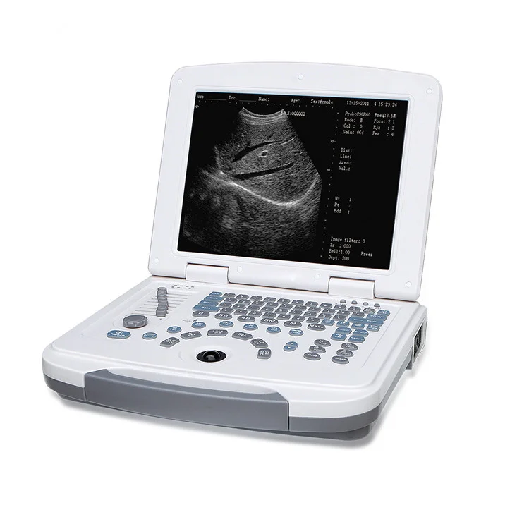 Full Digital Laptop Ultrasound Scanner