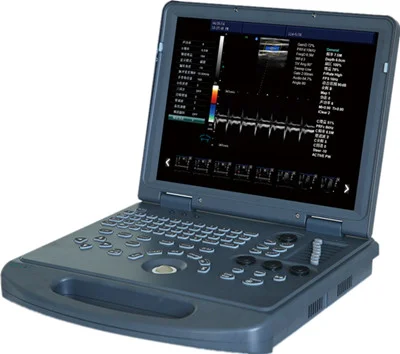 2D Full Digital Laptop Color Doppler — view 2