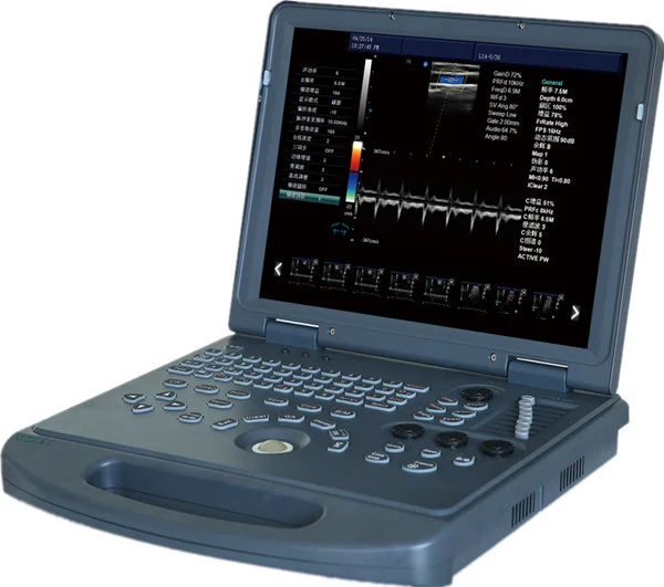 2D Full Digital Laptop Color Doppler